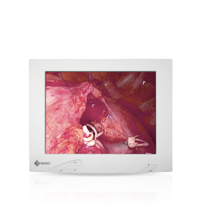 RadiForce ES150