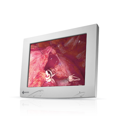 RadiForce ES150