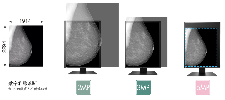 View Mammography Images Clearly