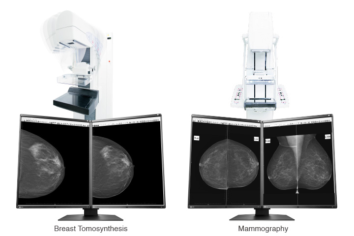 Optimum Breast Screening Monitor