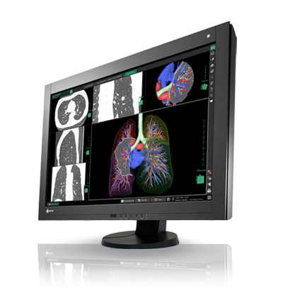RadiForce RX440
